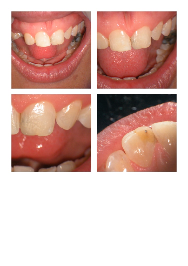 DB anterior case pg 1.jpg